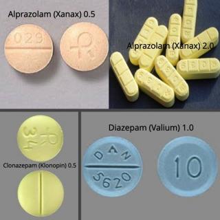Anxiety Treatment