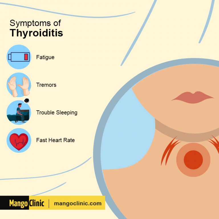 Thyroid Inflammation Can Be a Cause of Anxiety and Stress – Mango Clinic