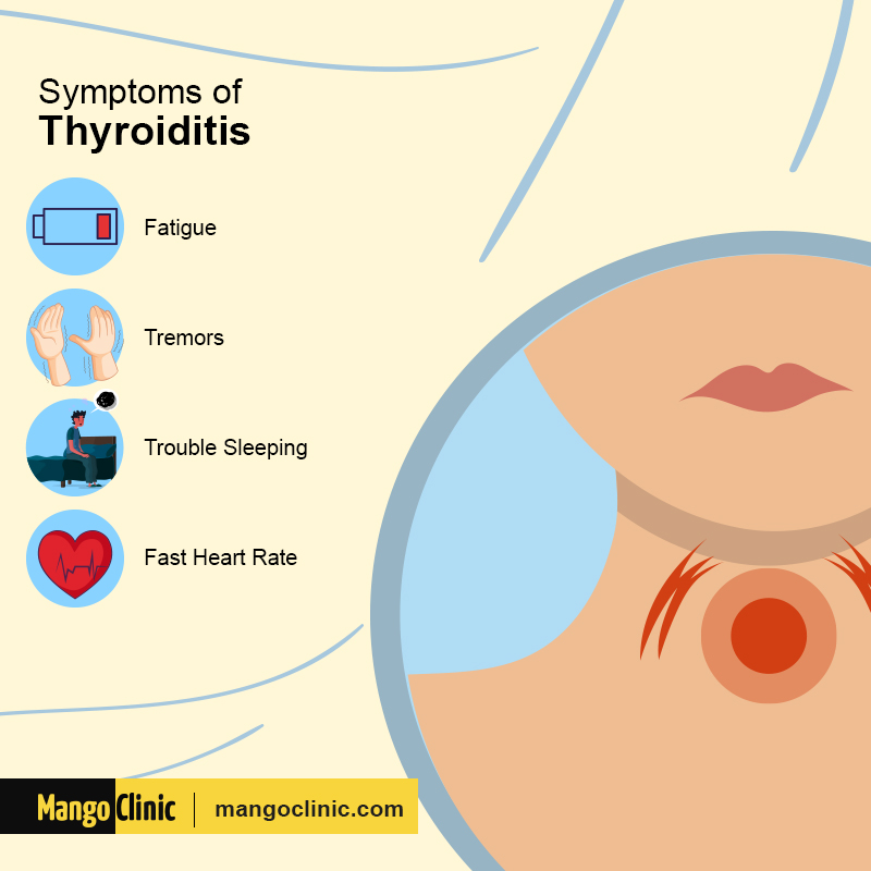 Symptoms of Thyroiditis