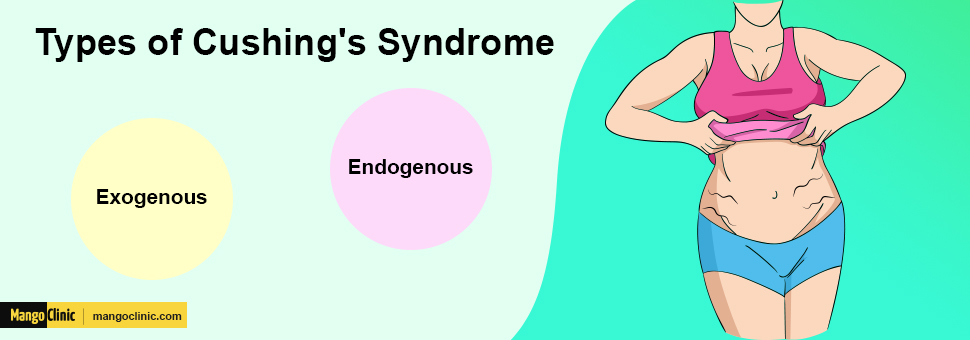 Cushing's Syndrome