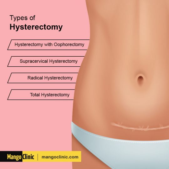 Weight Loss after a Hysterectomy and Its Side Effects? · Mango Clinic