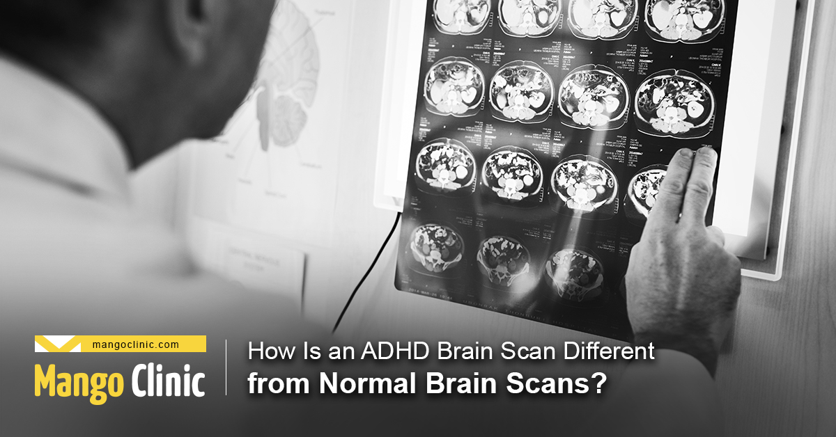 How Is An Adhd Brain Scan Different From Normal Brain Scans