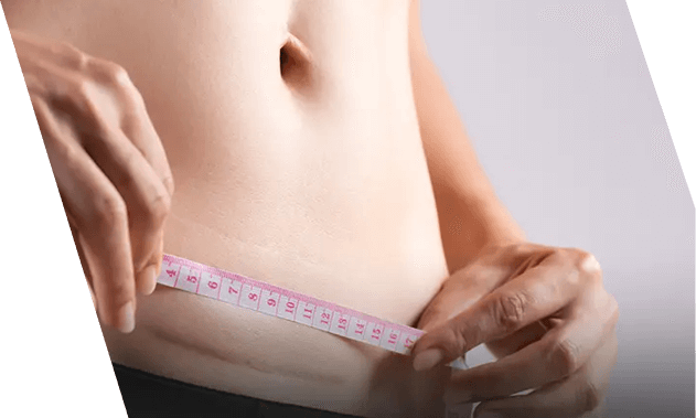 Weight Loss after a Hysterectomy and Its Side Effects Mango Clinic